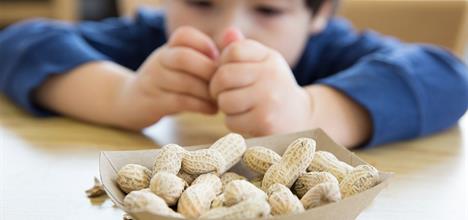 Food Allergies