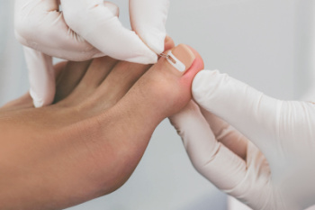 Ingrown Toenail Pain Relief