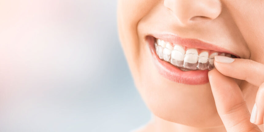 Invisalign
