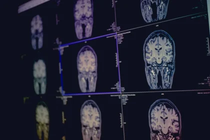 Diagnosis of Cognitive Disorders