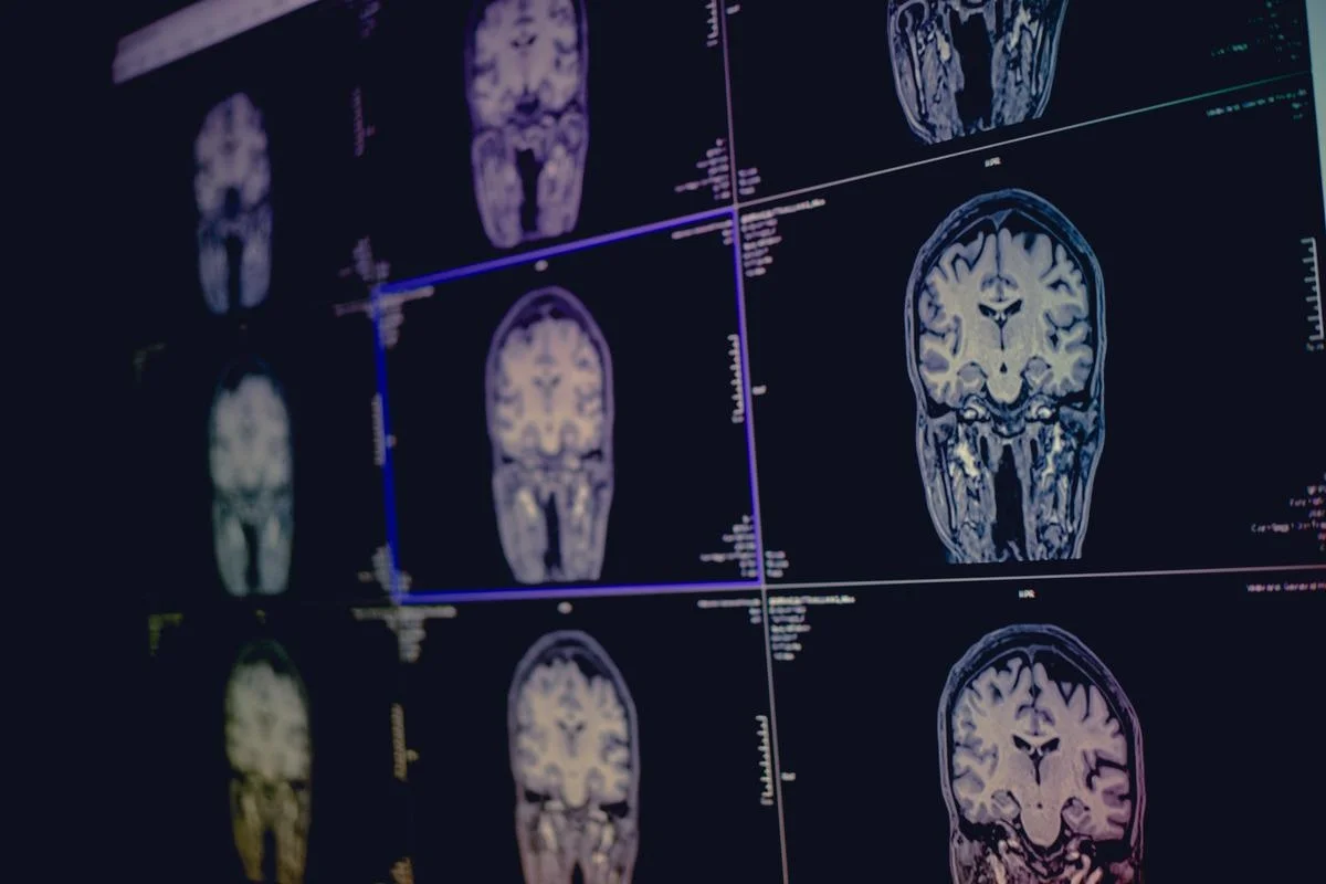 Diagnosis of Cognitive Disorders
