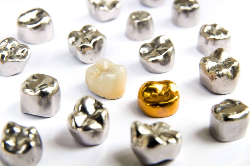 Different Types of Dental Crowns