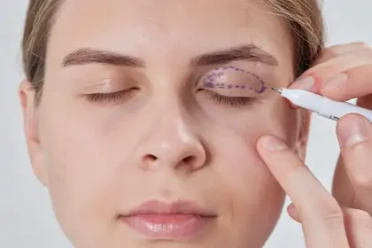 Eyelid Surgery