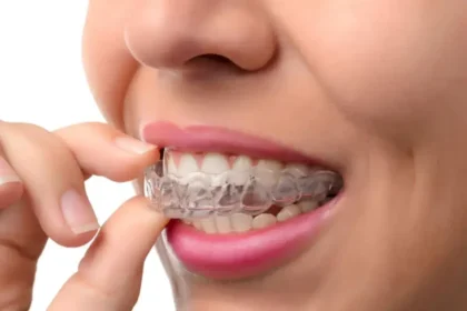 Invisalign Treatment Plan