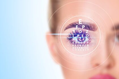 Lasik