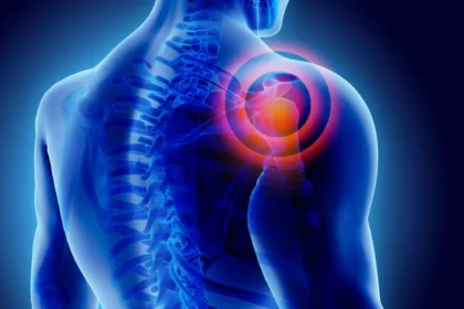 Ligament Tears in the Shoulder