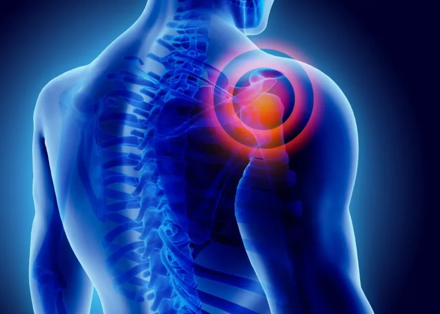 Ligament Tears in the Shoulder
