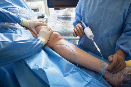 Procedures Offered by Vascular Surgeons