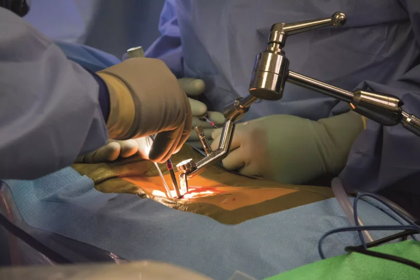 Spine Surgery Procedures