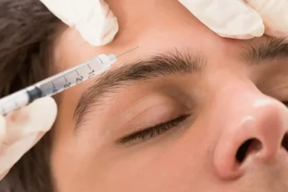 Botox for Migraines