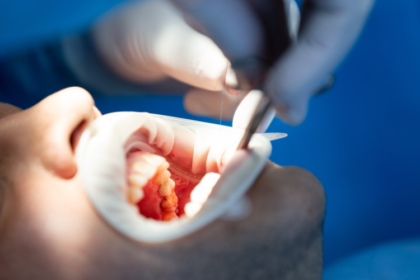 Oral Surgery