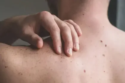 Various Skin Conditions