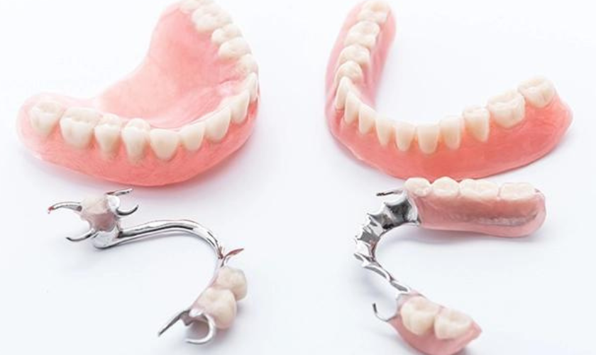 Full vs. Partial Dentures