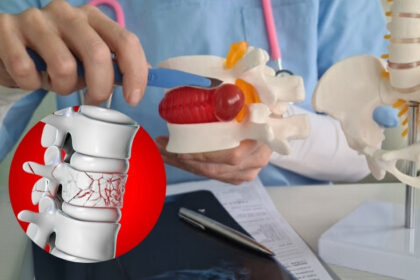 Kyphoplasty vs. Vertebroplasty