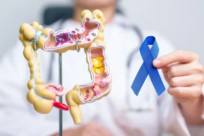 Colon Cancer Screening