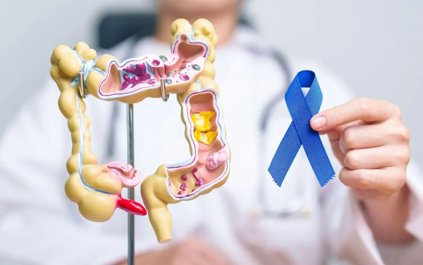 Colon Cancer Screening