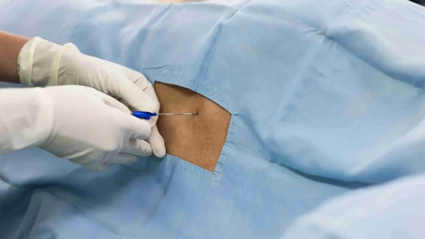 Epidural Injections