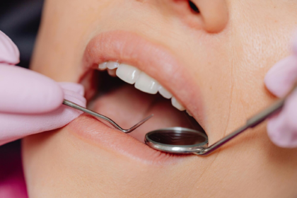 The Restoration Options Worth Knowing After Tooth Loss